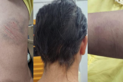 Mãe é presa em Manaus por espancar e cortar o cabelo da filha de 13 anos com faca
